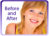 Before and After Orthodontic Treatment Toronto ON