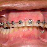 Scarborough braces Dr. James Noble